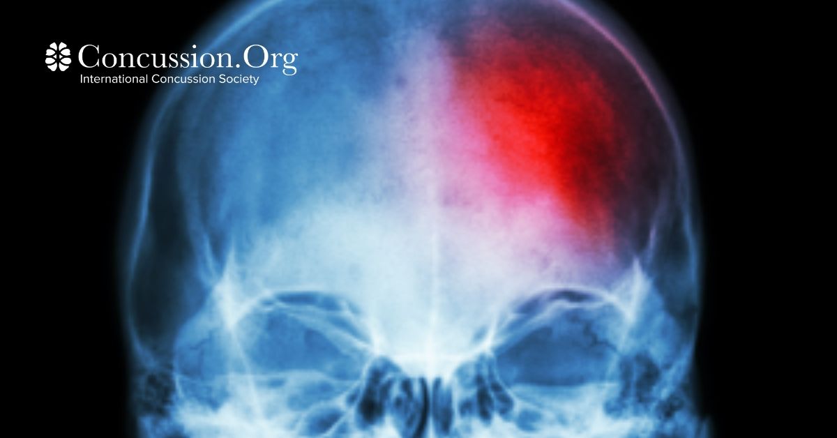 Red pain mark on skull x-ray